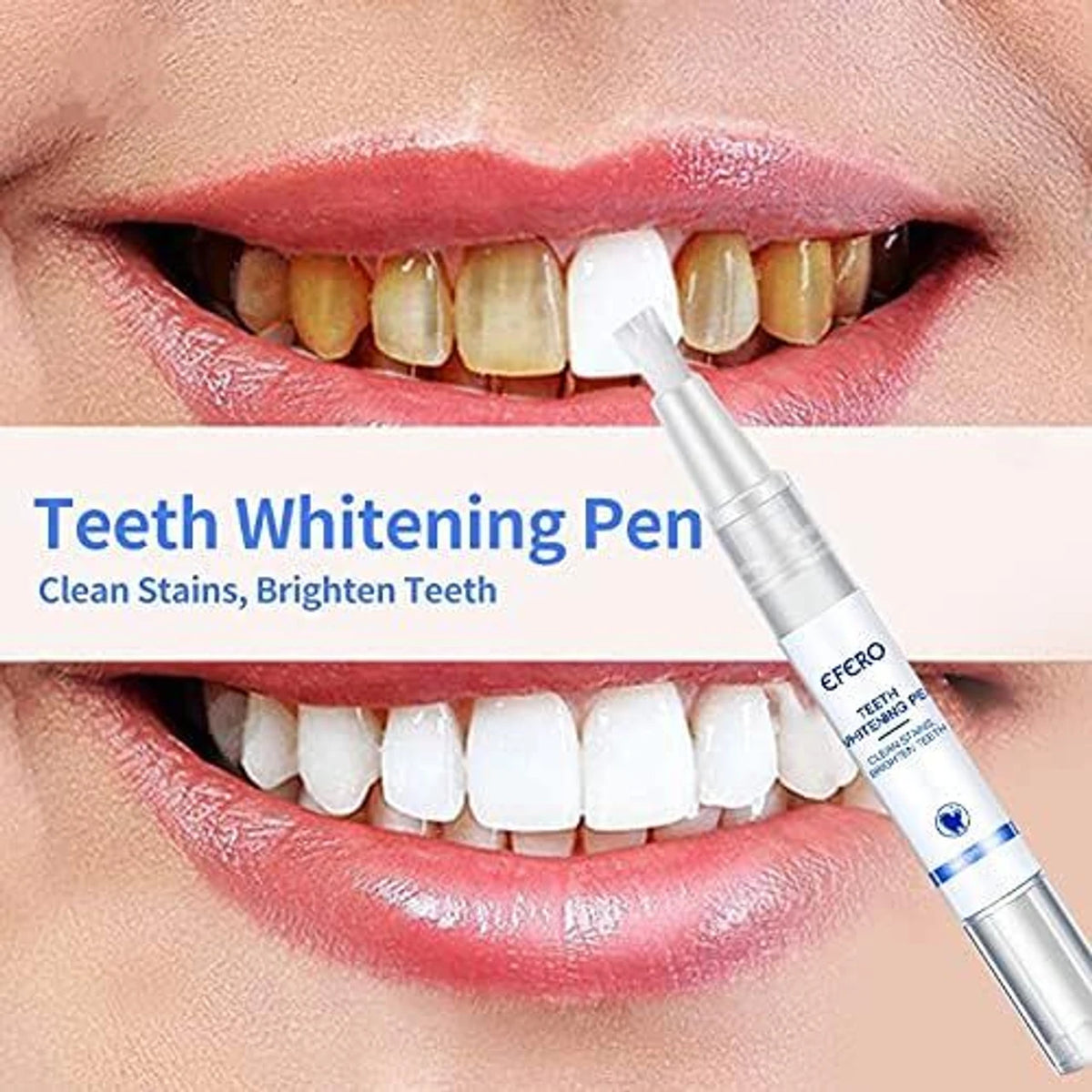 More Confident Smile—Anytime, Anywhere! - Teeth Whitening Gel Pen